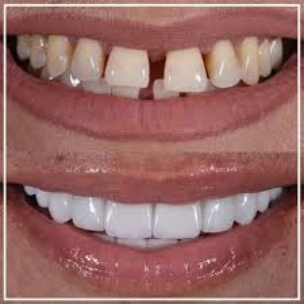 Dental treatment in Turkey: Engineering Your Perfect Smile in 2025 1 Dental Treatment Available in Turkey