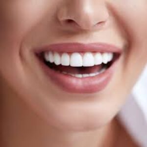 Hollywood Smile Makeover Package - 20 Zirconia Crowns 3 Hollywood Smile Makeover Package