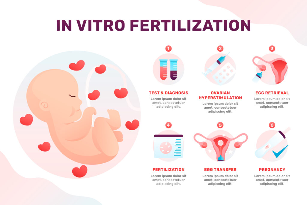IVF in Turkey: Your Hopeful 2025 Complete Guide 3 In vitro fertilization process in Turkey